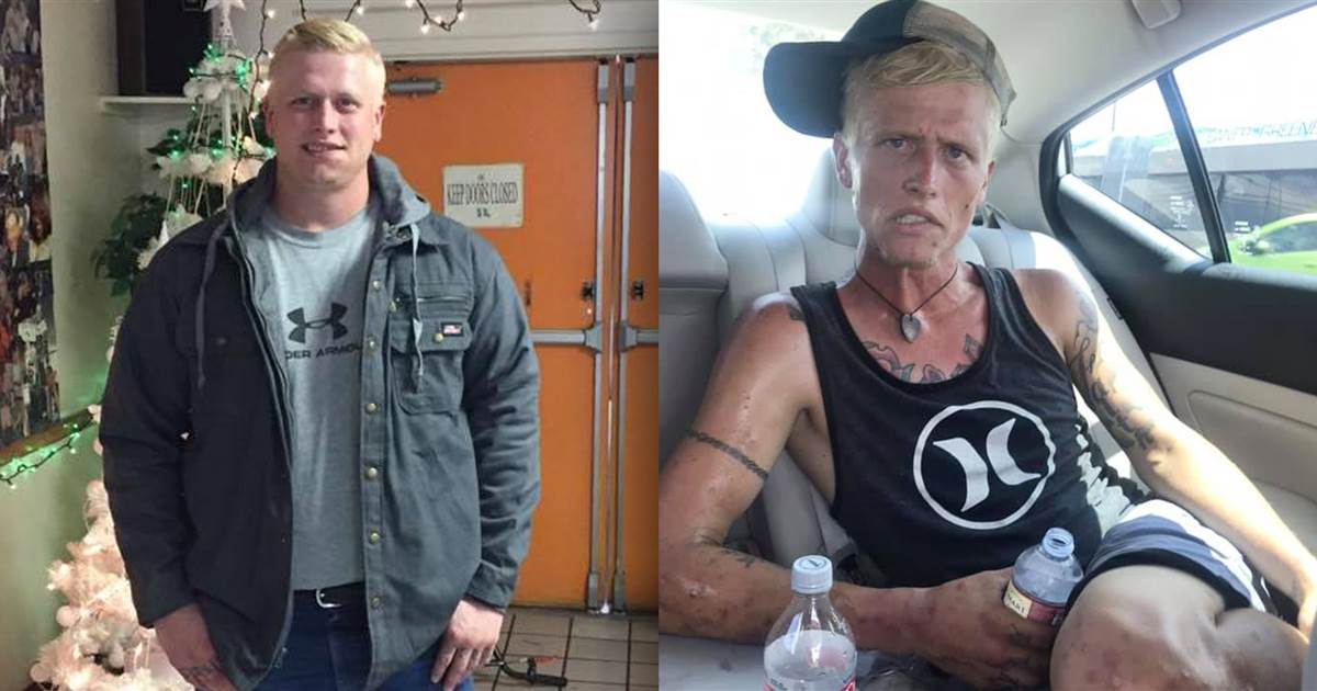 'The face of heroin': Mom shares haunting before and after photos of her addicted son