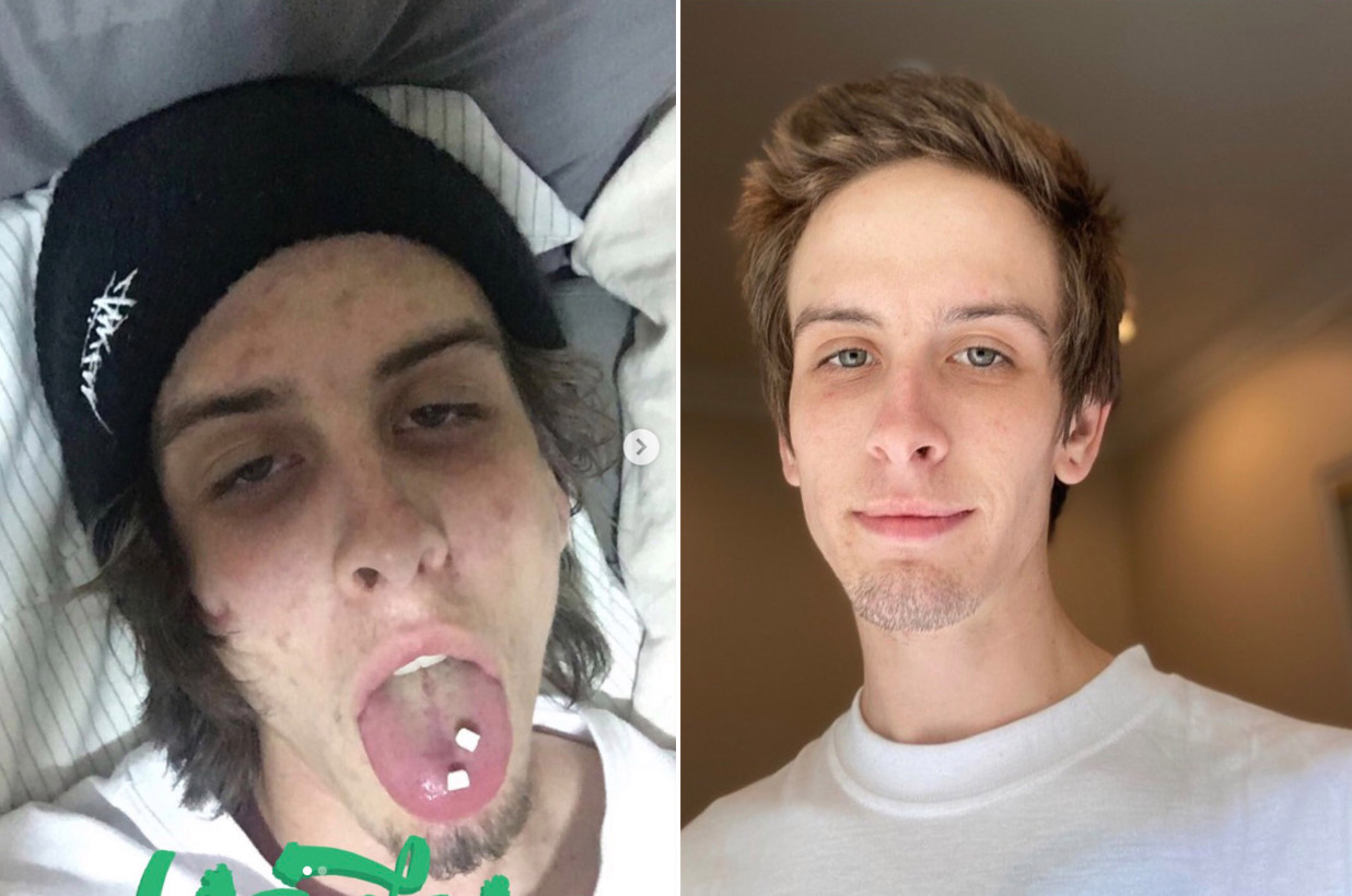 Former drug addict shares photos of his stunning transformation